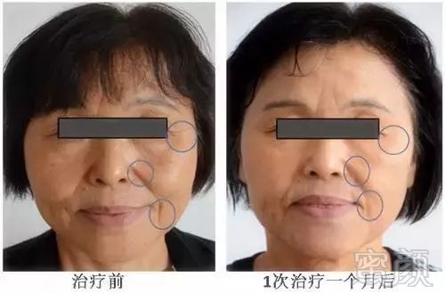 https://img.miyanlife.com/mnt/timg/190328/15451GG1-12.jpg