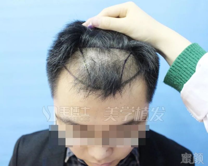 https://img.miyanlife.com/mnt/timg/190328/1545222G1-0.jpg