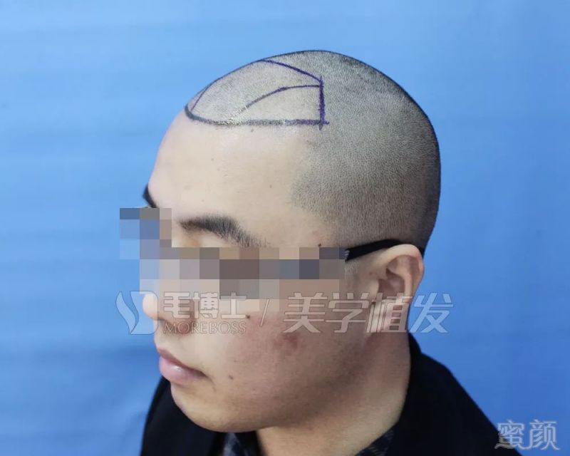 https://img.miyanlife.com/mnt/timg/190328/1545254009-1.jpg