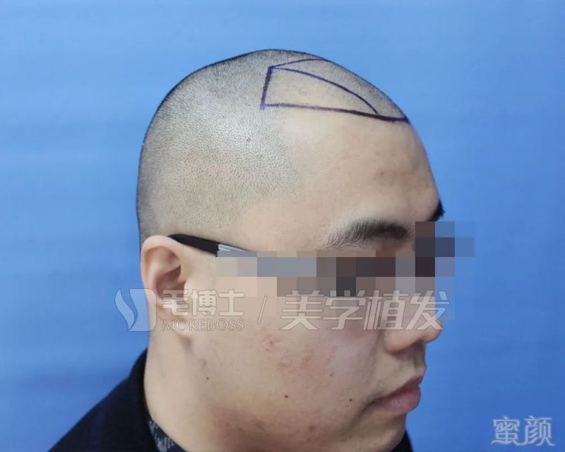 https://img.miyanlife.com/mnt/timg/190328/15452H602-2.jpg