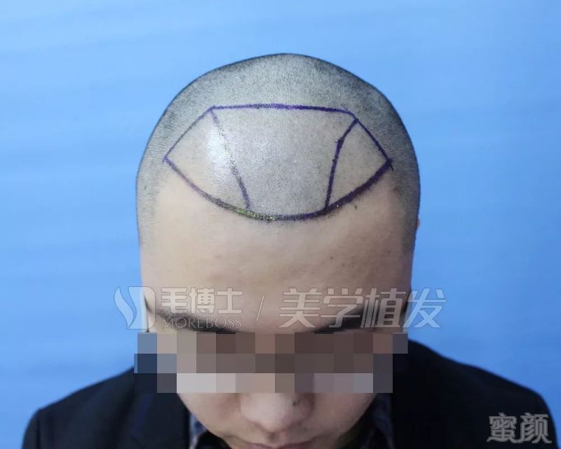 https://img.miyanlife.com/mnt/timg/190328/1545303541-3.jpg