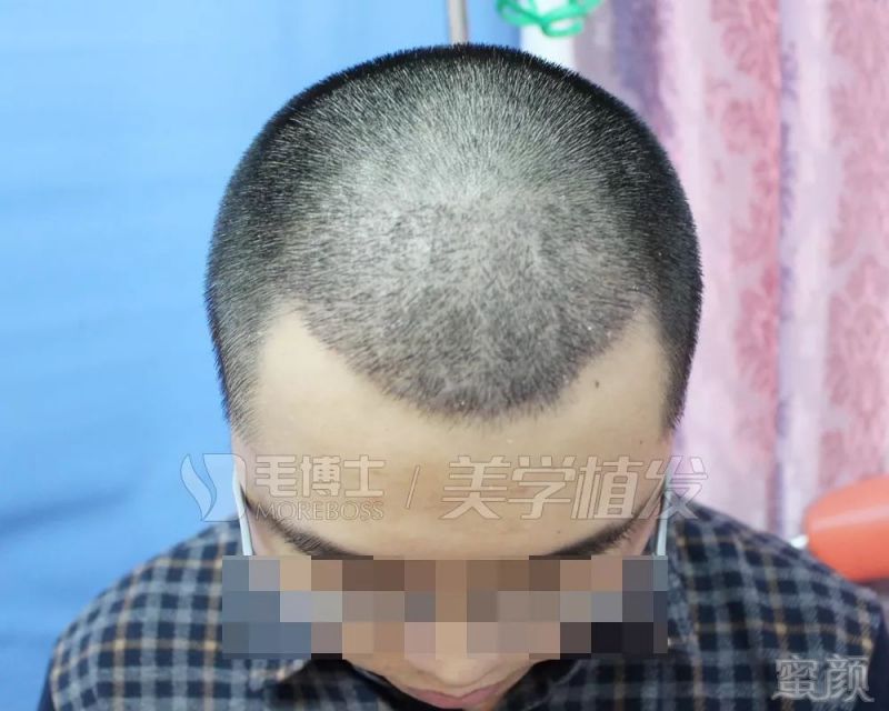 https://img.miyanlife.com/mnt/timg/190328/154532M60-4.jpg