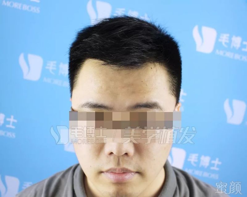 https://img.miyanlife.com/mnt/timg/190328/1545354A3-5.jpg