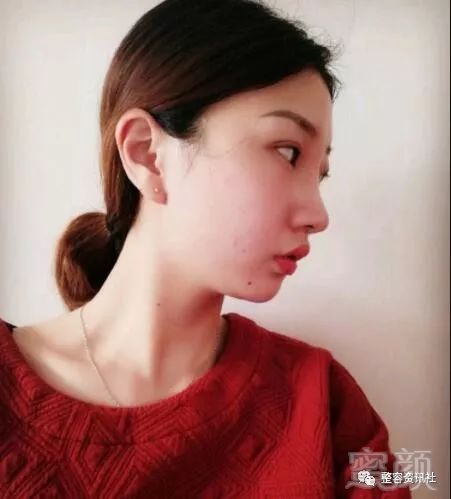 https://img.miyanlife.com/mnt/timg/190329/141R035P-2.jpg