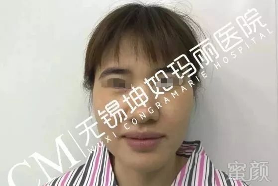 https://img.miyanlife.com/mnt/timg/190329/1440125626-0.jpg