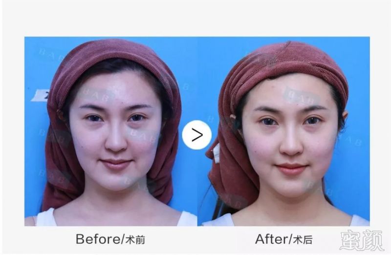 https://img.miyanlife.com/mnt/timg/190329/15062CR3-6.jpg