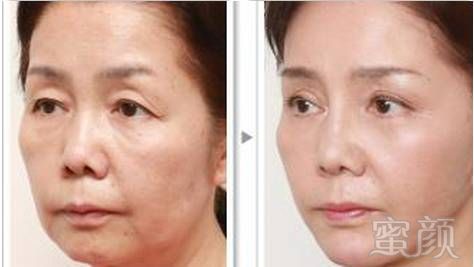 https://img.miyanlife.com/mnt/timg/190329/150929D03-3.jpg