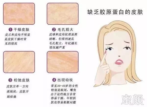 https://img.miyanlife.com/mnt/timg/190329/150931I41-10.jpg