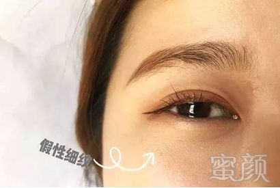 https://img.miyanlife.com/mnt/timg/190329/1554204L6-0.jpg
