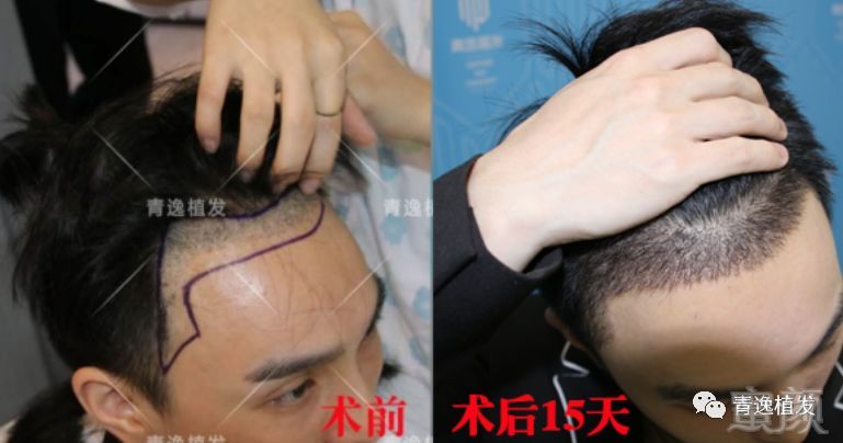 https://img.miyanlife.com/mnt/timg/190330/145013LH-1.jpg