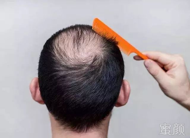 https://img.miyanlife.com/mnt/timg/190330/1459294132-0.jpg
