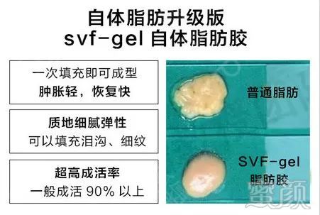 案例图片