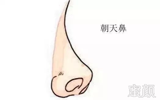 https://img.miyanlife.com/mnt/timg/190330/151T14593-5.jpg