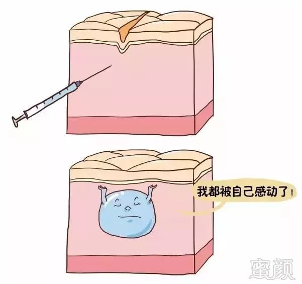 https://img.miyanlife.com/mnt/timg/190330/154A15X6-10.jpg