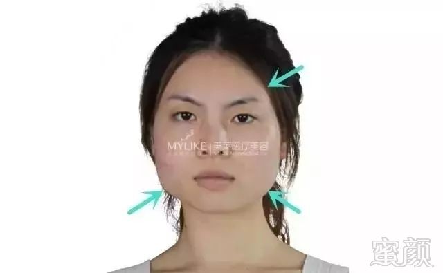 https://img.miyanlife.com/mnt/timg/190330/1551514064-3.jpg