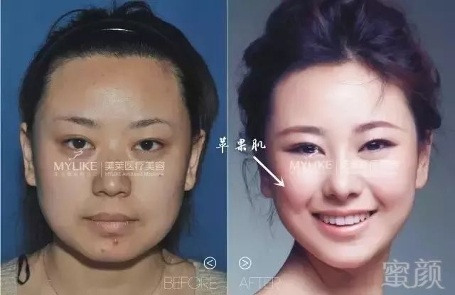 https://img.miyanlife.com/mnt/timg/190330/1551525316-7.jpg