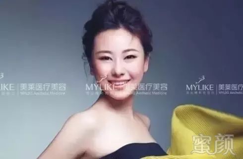 https://img.miyanlife.com/mnt/timg/190330/1551526232-8.jpg