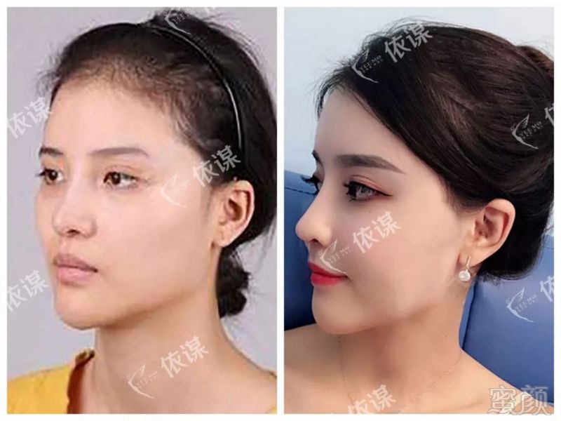 https://img.miyanlife.com/mnt/timg/190330/155P64H9-13.jpg