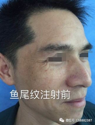 https://img.miyanlife.com/mnt/timg/190330/1605403360-2.jpg