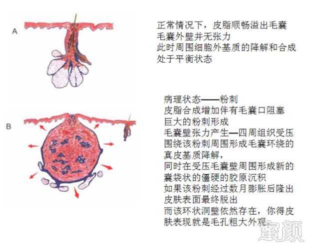 案例图片