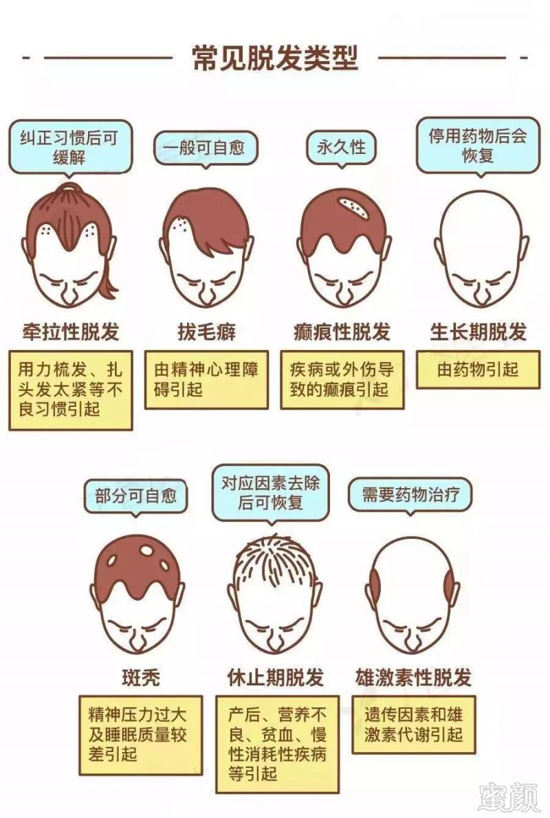 https://img.miyanlife.com/mnt/timg/190331/114G21093-3.jpg