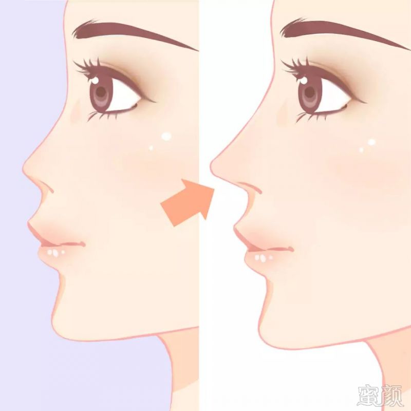 https://img.miyanlife.com/mnt/timg/190331/1221322S9-1.jpg