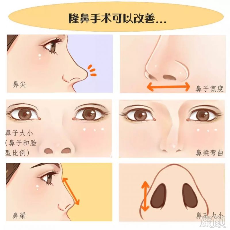https://img.miyanlife.com/mnt/timg/190331/1221331932-2.jpg