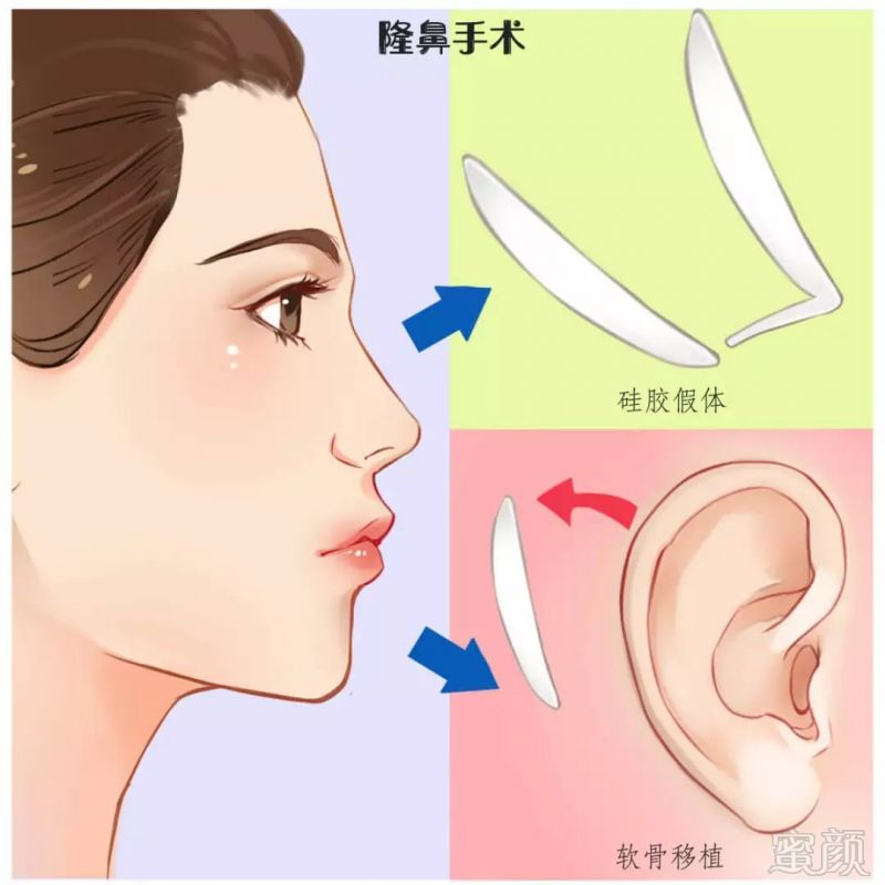 https://img.miyanlife.com/mnt/timg/190331/1221362623-3.jpg