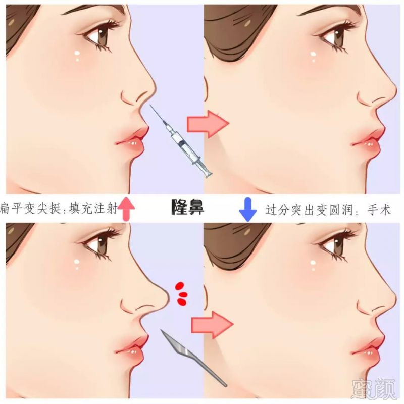 https://img.miyanlife.com/mnt/timg/190331/1221415556-6.jpg
