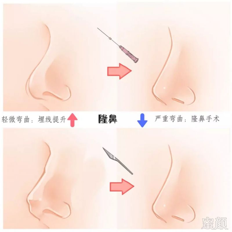 https://img.miyanlife.com/mnt/timg/190331/1221426155-7.jpg