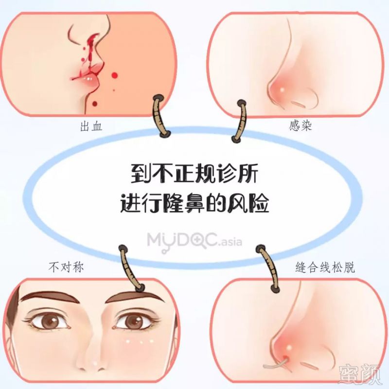 https://img.miyanlife.com/mnt/timg/190331/12214L935-11.jpg