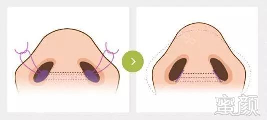 https://img.miyanlife.com/mnt/timg/190331/123U3J43-4.jpg