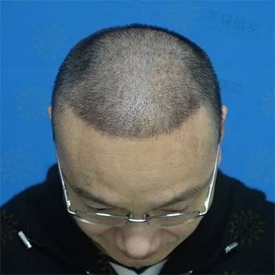 https://img.miyanlife.com/mnt/timg/190402/1352093035-2.jpg