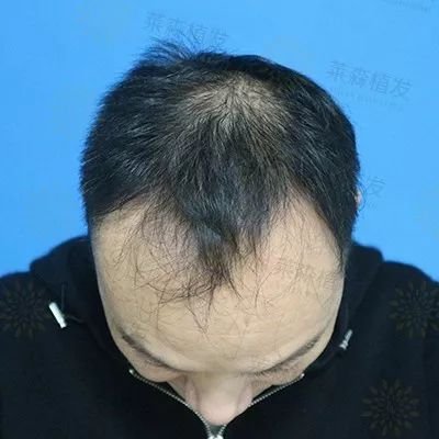 https://img.miyanlife.com/mnt/timg/190402/13520G509-0.jpg