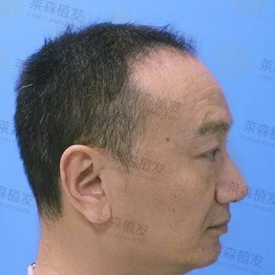 https://img.miyanlife.com/mnt/timg/190402/1352103263-4.jpg