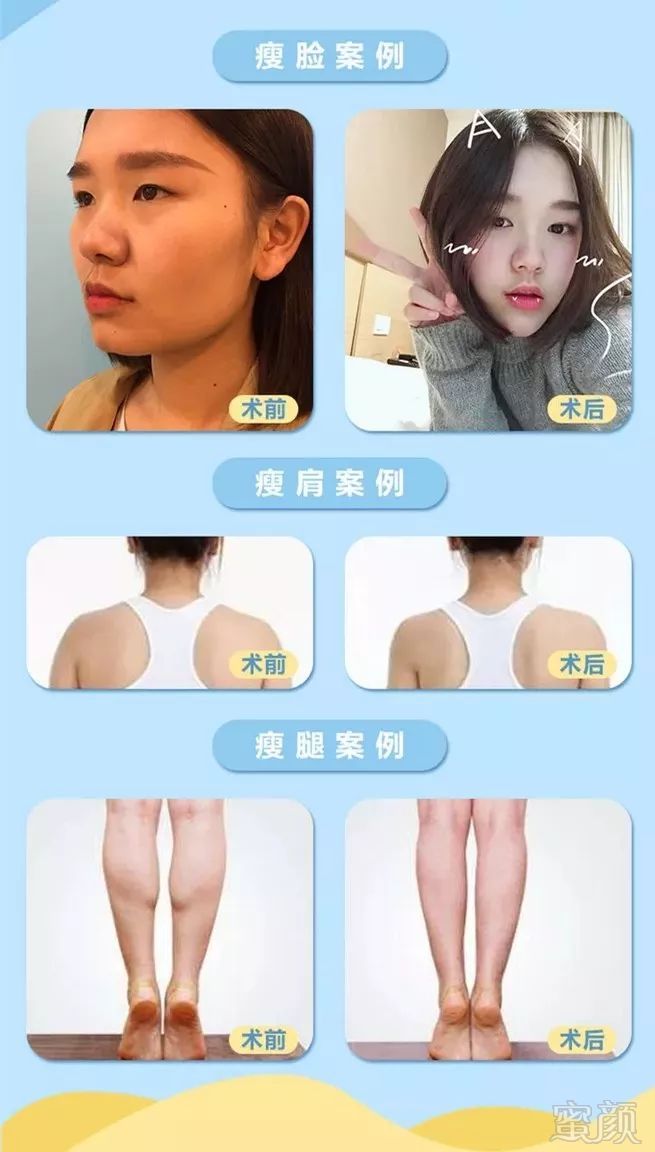 https://img.miyanlife.com/mnt/timg/190402/140II1M-6.jpg