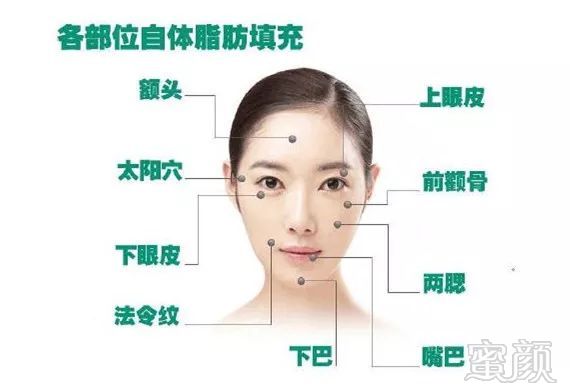 https://img.miyanlife.com/mnt/timg/190402/141535B55-7.jpg