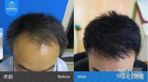 https://img.miyanlife.com/mnt/timg/190403/1311111Y2-0.jpg