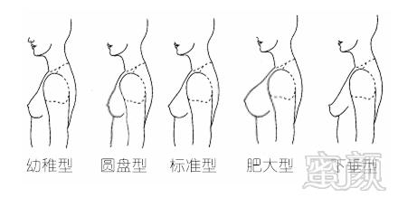 案例图片