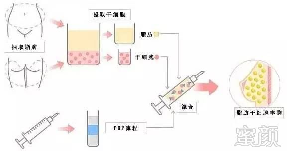 案例图片