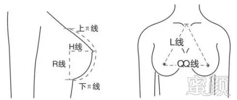 案例图片