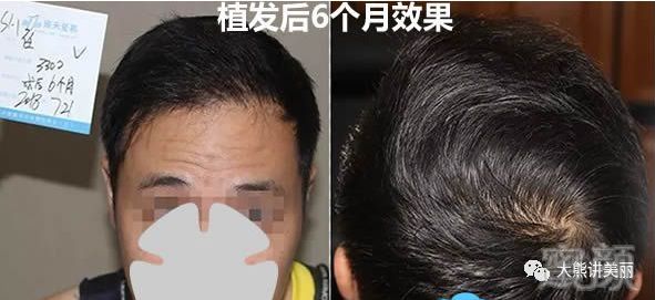 https://img.miyanlife.com/mnt/timg/190404/13312aB7-2.jpg