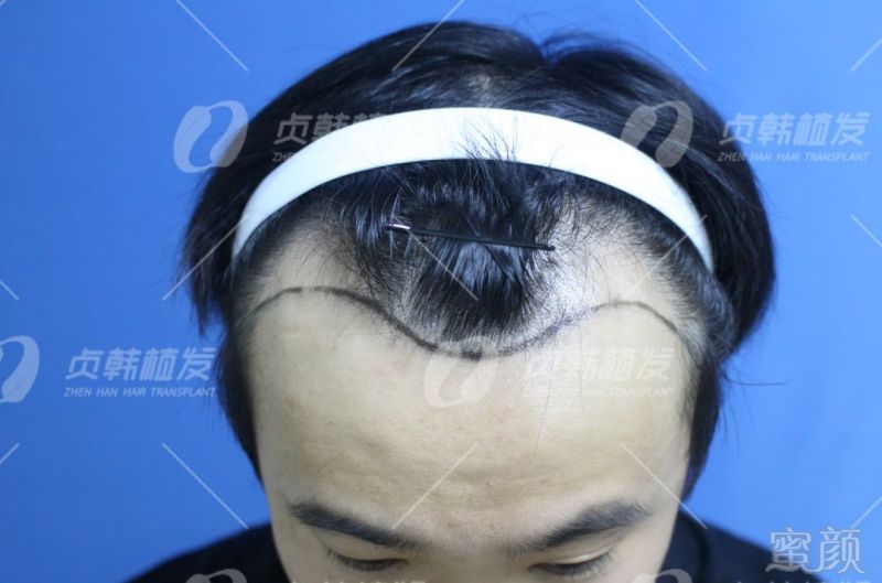 https://img.miyanlife.com/mnt/timg/190404/133U01095-1.jpg