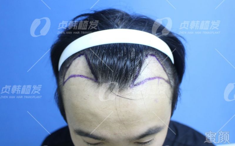 https://img.miyanlife.com/mnt/timg/190404/133U110Q-2.jpg
