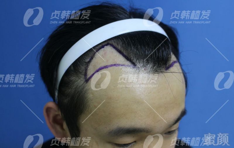 https://img.miyanlife.com/mnt/timg/190404/133U1FZ-3.jpg
