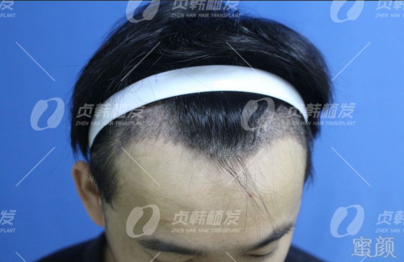 https://img.miyanlife.com/mnt/timg/190404/133U36129-7.jpg