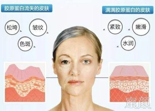 https://img.miyanlife.com/mnt/timg/190410/110I964M-1.jpg