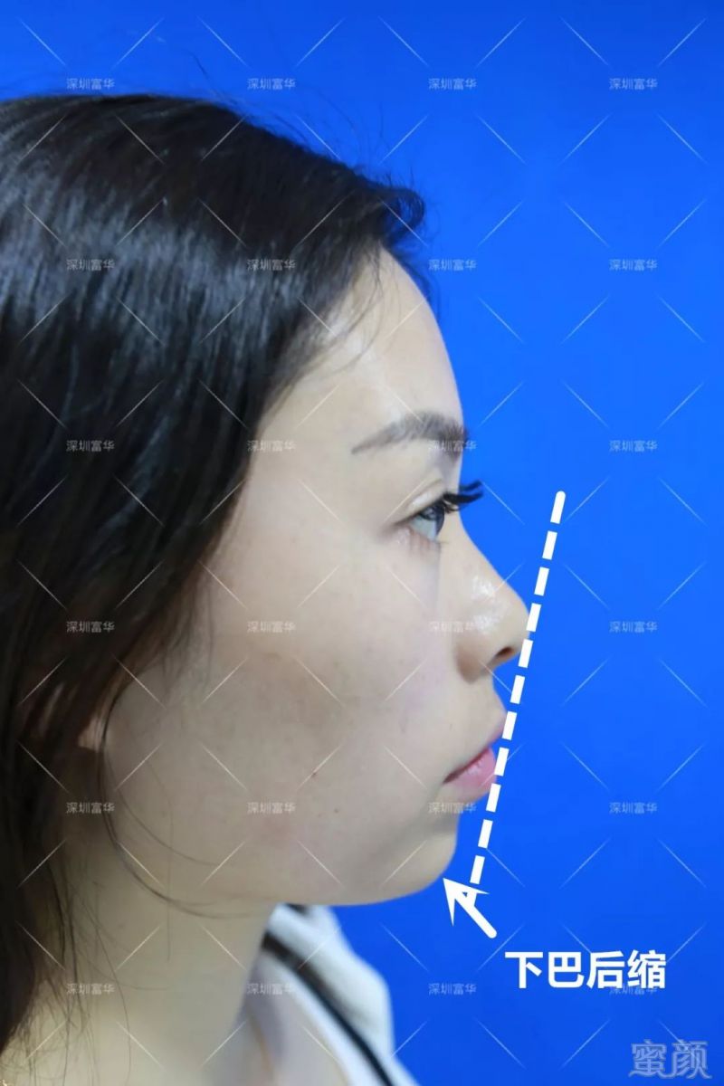 https://img.miyanlife.com/mnt/timg/190411/1051354237-4.jpg