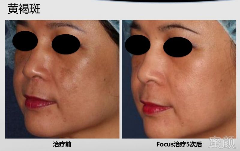 https://img.miyanlife.com/mnt/timg/190411/111T43Y3-1.jpg