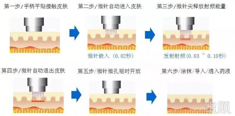 案例图片